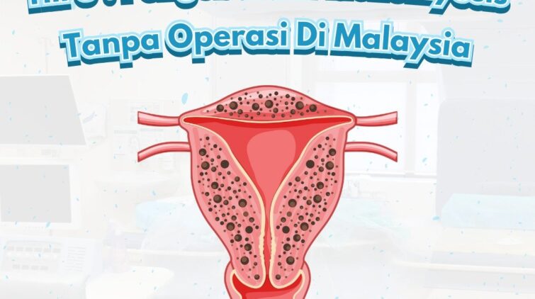 HIFU : Pengobatan Miom & Adenomiosis Tanpa Operasi Di Malaysia