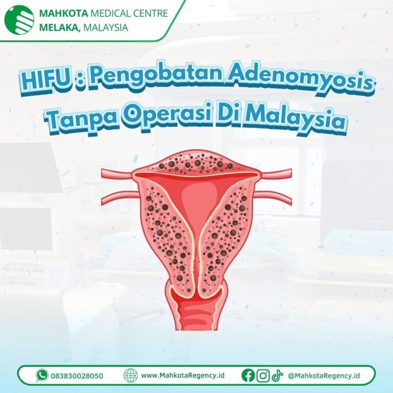 HIFU : Pengobatan Miom & Adenomiosis Tanpa Operasi Di Malaysia